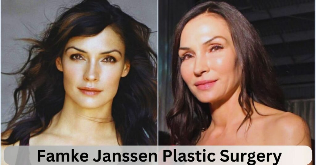 Famke Janssen Plastic Surgery