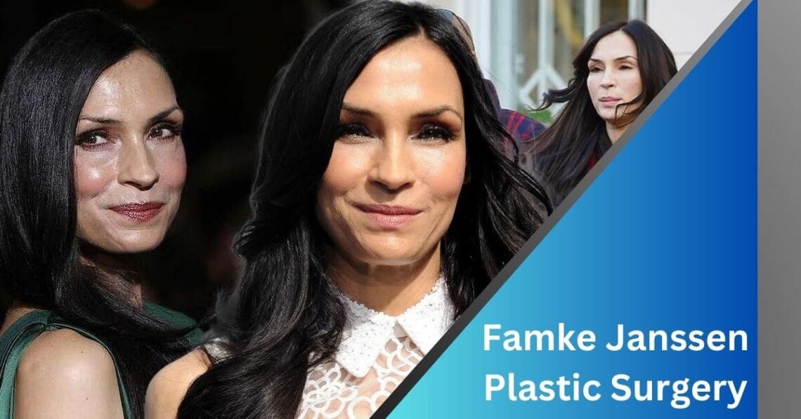 Famke Janssen Plastic Surgery