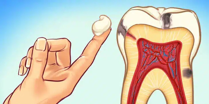 What Is A Tooth Pain? 